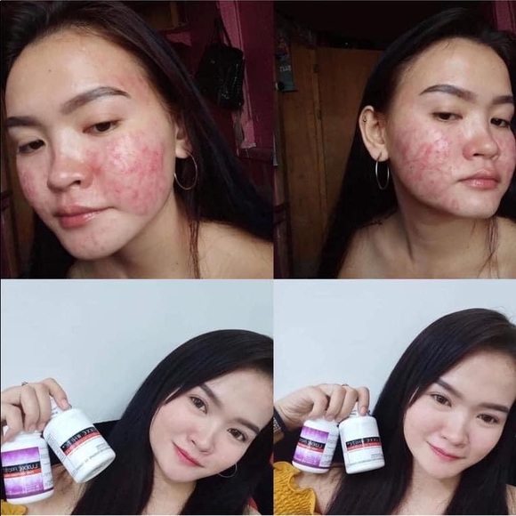 Frontrow Luxxe - Picture 2 of 10